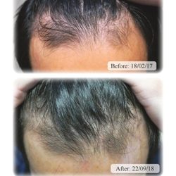 Australian Hair & Scalp Clinic