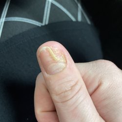Island Nail and Spa - I got nail fungus from this place IT IS NOT CLEAN THERE!