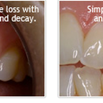 Leo Arellano, DDS PC - Gum Grafting - General Dentistry Near Me - San Francisco, California Leo Arellano, DDS PC - Gum Grafting - General Dentistry Near Me - San Francisco, California
