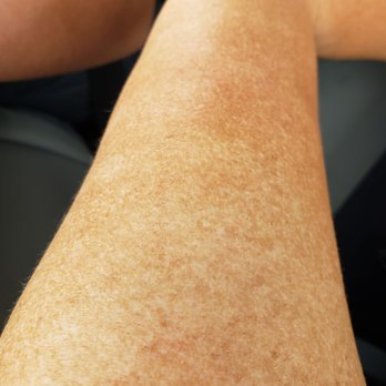 The Tan Bar - Spray Tanning Near Me - Dallas, Texas