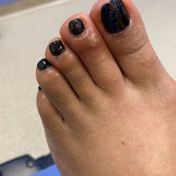 Venezia Nail Spa - Staph infection from Venezia Nail Spa - Nail Salons Near Me - Prosper, Texas