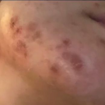 Sessions with Loana - Skin Care Near Me - Wildomar, California