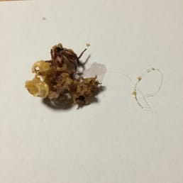 Hair found in calamari Hair found in calamari