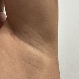 Underarms