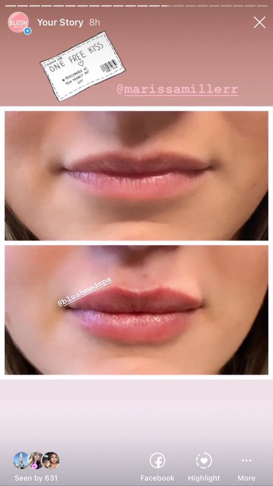 BLUSH MED SPA 42 Photos & 11 Reviews 115 Elm St, Enfield, Connecticut Medical Spas Phone