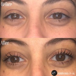 Before and After