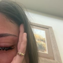 Swollen eye