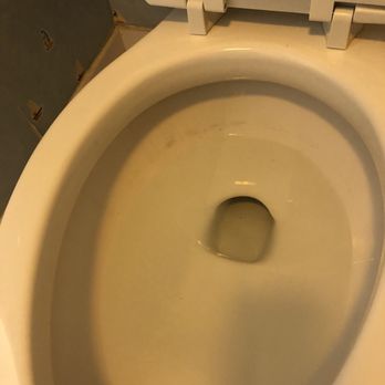 Kingston Plantation Condominium Resort - Dirty toilet - Resorts Near Me - Myrtle Beach, South Carolina Kingston Plantation Condominium Resort - Dirty toilet - Resorts Near Me - Myrtle Beach, South Carolina