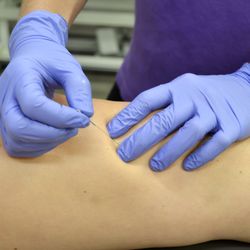 IMPACT Physical Therapy & Sports Recovery - Oak Lawn