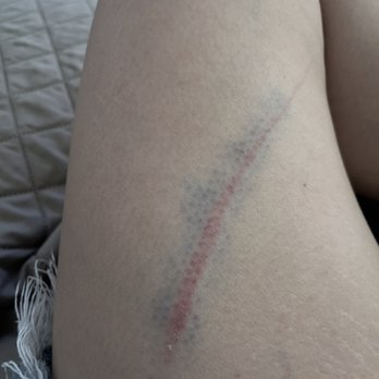 Wildcatters Dog Park - The scratch the other owner's dog left on me - Dog Parks Near Me - Brea, California