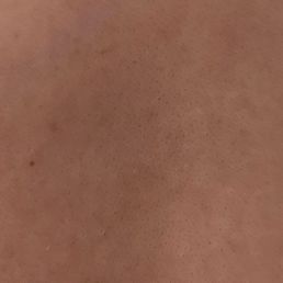 3 bumps total 3 bumps total