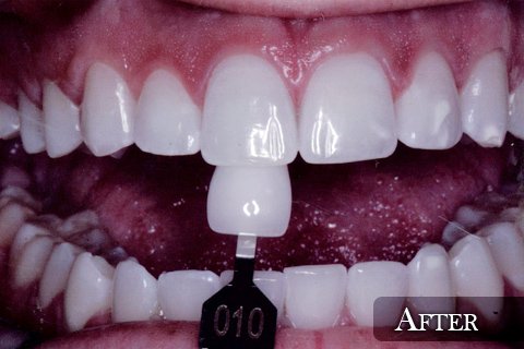 John E Carder, DDS - sleep specialist in State College, PA