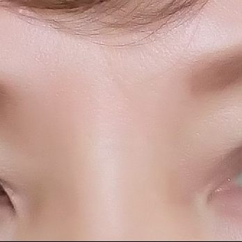 Jed H. Horowitz, MD, FACS - 2 months after with painted eyebrows - Cosmetic Surgeons Near Me - Newport Beach, California Jed H. Horowitz, MD, FACS - 2 months after with painted eyebrows - Cosmetic Surgeons Near Me - Newport Beach, California