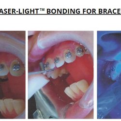 James A Nicholson DDS, MS - Braces By Nicholson