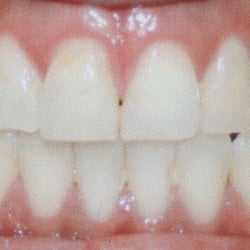 Broadbent Orthodontics