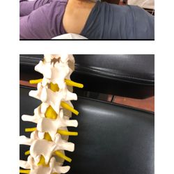 Pain Management & Acupuncture Healing - The spinal nerve foramen  has transverse ligament,  release the tension of foramenal transverse ligament will enlarged the nervous space