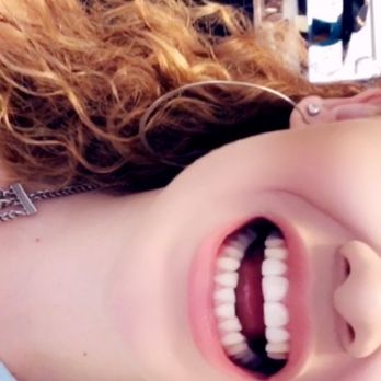 Campus Dentistry - I got my 4 front teeth fixed (veneers) - General Dentistry Near Me - San Diego, California Campus Dentistry - I got my 4 front teeth fixed (veneers) - General Dentistry Near Me - San Diego, California