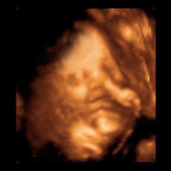 Stork Vision Frisco - Picking his nose and smiling - Diagnostic Imaging Near Me - Frisco, Texas Stork Vision Frisco - Picking his nose and smiling - Diagnostic Imaging Near Me - Frisco, Texas