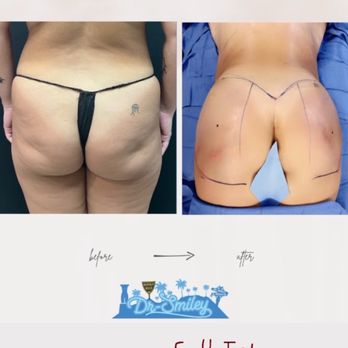 Tarick Smiley, MD - Cosmetic Surgeons Near Me - Beverly Hills, California