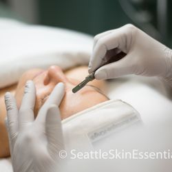 Seattle Skin Essentials - Dermaplaning makes you a smooth operator