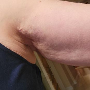 Hootan Daneshmand, MD - extra skin just hanging . Horrible !! - Cosmetic Surgeons Near Me - Foothill Ranch, California Hootan Daneshmand, MD - extra skin just hanging . Horrible !! - Cosmetic Surgeons Near Me - Foothill Ranch, California