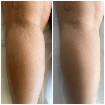 Boleyn studio - Permanent Makeup Near Me - Beverly Hills, California