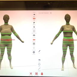 My before and after transformation scan!