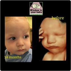 4D Imaging - Amazing before and after pic. Time flies!