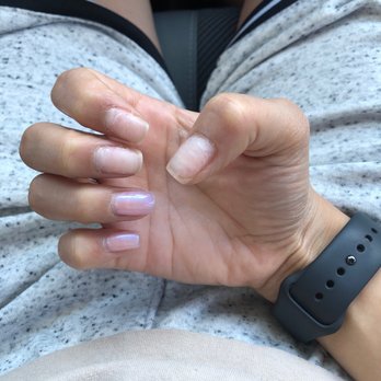 Serenity Nails Spa - Other nails peeling - Nail Salons Near Me - Vacaville, California