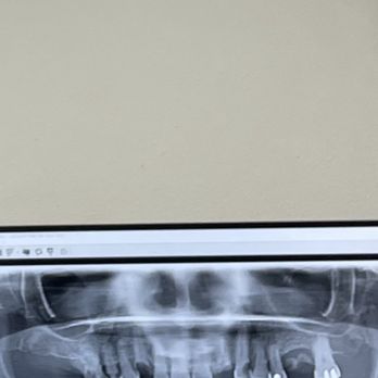 Bobby Jivnani Plano Dental - Work needed - Oral Surgeons Near Me - Plano, Texas