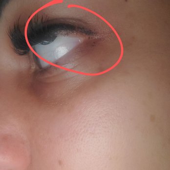 Contour By Gabs - There were 2 strips here that fell off and now I'm pretty much bald here. See for yourself. Also note another strip sagging into my eye. - Skin Care Near Me - San Diego, California