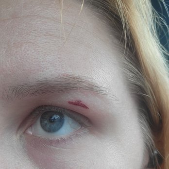 SUPERCUTS - Right eye after two days. - Hair Salons Near Me - ARROYO GRANDE, California