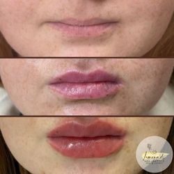 Lemonade Aesthetics Spa and Clinic