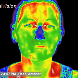Natural Medicine Center of Lakeland - Sinus Congestion