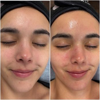 Elegant Esthetics - Skin Care Near Me - Huntington Beach, California Elegant Esthetics - Skin Care Near Me - Huntington Beach, California
