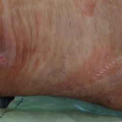 The Belmont At Twin Creeks - This is my mother-in-law's back. I cannot show the rest for privacy and restrictions