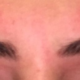 A whole chunk of eye brow on left is missing and arches are visibly uneven