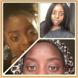 Estique - After dermafile