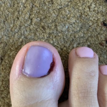 American Nail Salon - Pedicure gone wrong - Nail Salons Near Me - Albany, Georgia