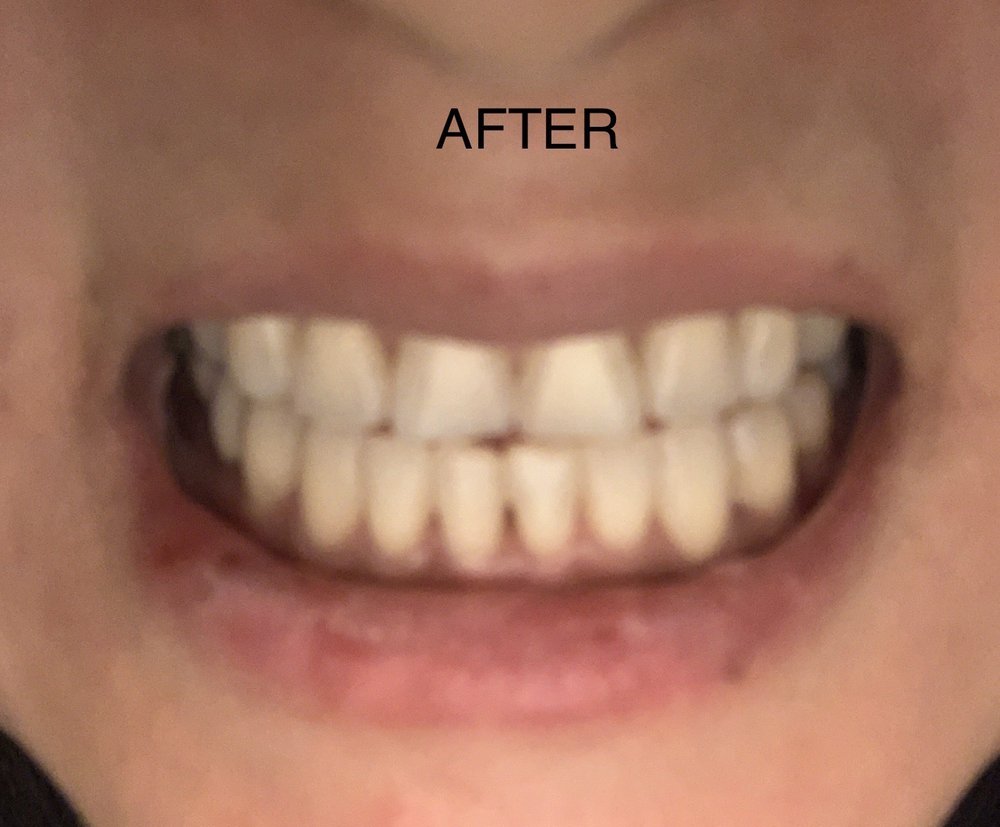 The Brace Place & Kids Dentistry - sleep specialist in Bellflower, CA