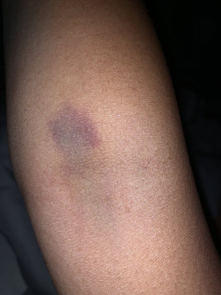 PRO VAC SERVICES Updated July 2024 Brampton, Ontario Diagnostic Imaging Phone Number Yelp