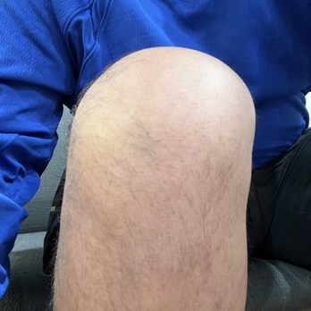 Eli Ahdoot - Minimally Invasive - Regular Knee on the right (non damaged) - Orthopedists Near Me - Burbank, California