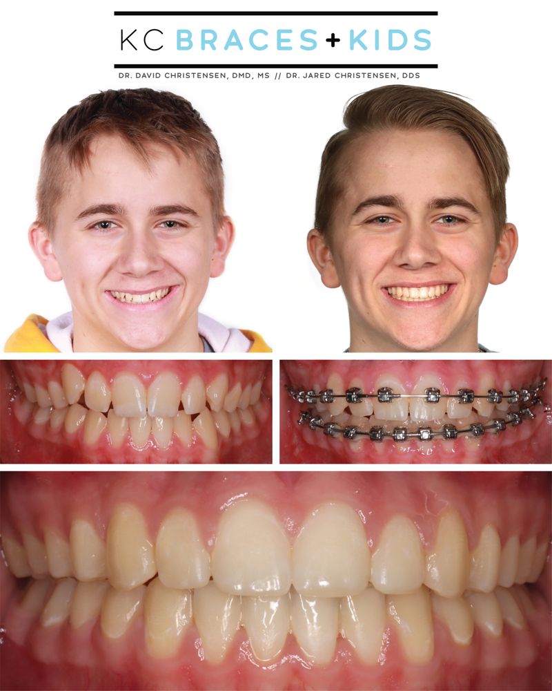 KC BRACES AND KIDS Updated October 2024 20 Photos 7675 NW Prairie