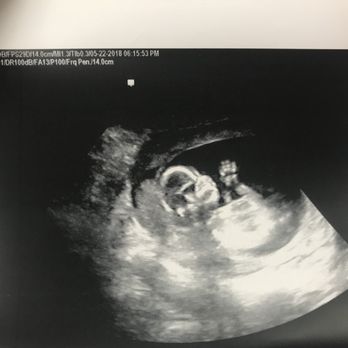 Kicks and Giggles - Ultrasound Imaging Centers Near Me - Provo, Utah