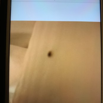 DoubleTree by Hilton Hotel Modesto - Bed bugs - Hotels Near Me - Modesto, California DoubleTree by Hilton Hotel Modesto - Bed bugs - Hotels Near Me - Modesto, California