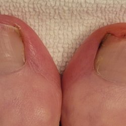PA Foot & Ankle Associates