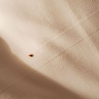 Century Plaza - Theres another bed bug. - Hotels Near Me - Vancouver, British Columbia Century Plaza - Theres another bed bug. - Hotels Near Me - Vancouver, British Columbia