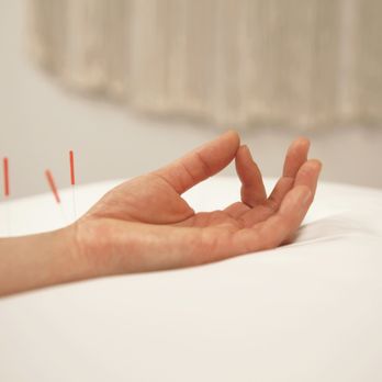 Espiritu Acupuncture and Wellness - Acupuncture Near Me - Thousand Oaks, California Espiritu Acupuncture and Wellness - Acupuncture Near Me - Thousand Oaks, California