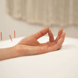 Espiritu Acupuncture and Wellness