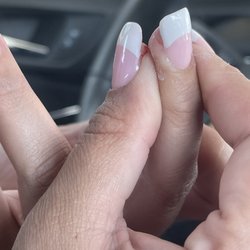 Top Nails - Cuts on finger